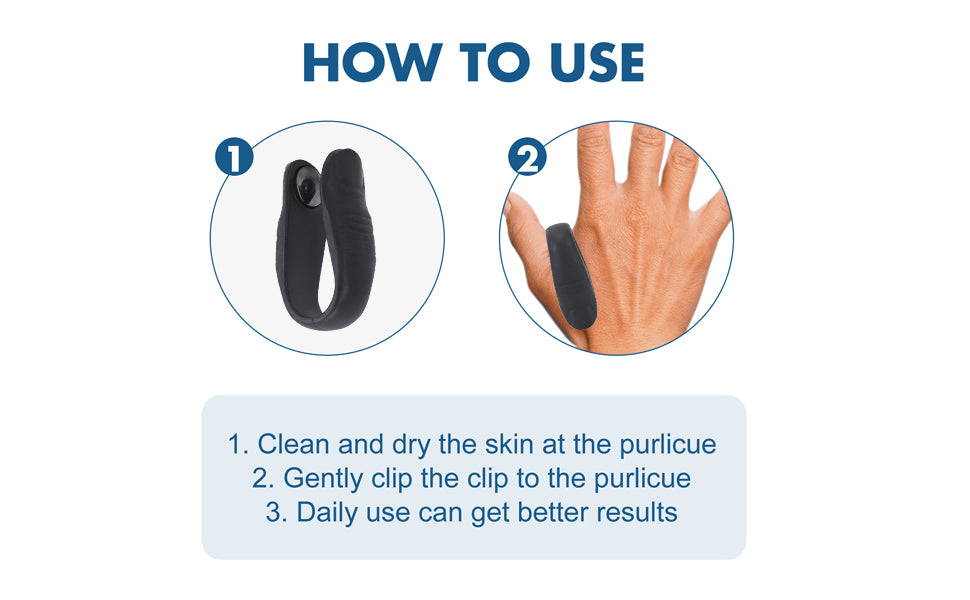 “Stay Healthy Naturally – LI4 Sugar Control Acupressure Clips (2 in 1 Pack)”